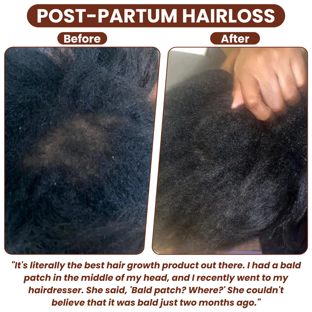 Grows Pure Batana Oil